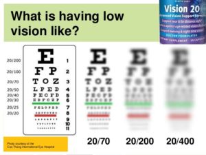 Vision 20 Supplement Review - Zenith Labs - Is it legit?
